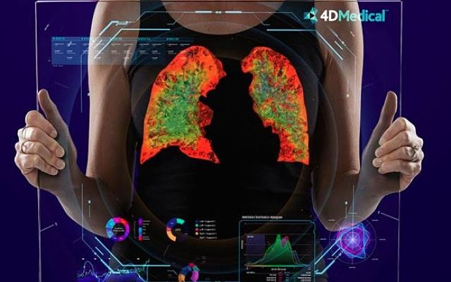 4DMedical ASX 4DX Lung Ventilation SaaS TGA approval FDA