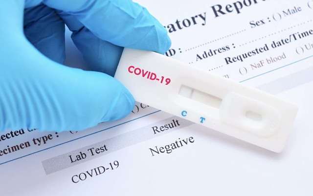 Cellmid rapid diagnostic test COVID-19 coronavirus CDY ASX