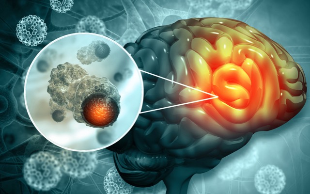 Chimeric Therapeutics ASX CHM ethics approval phase 1B study patients brain cancer