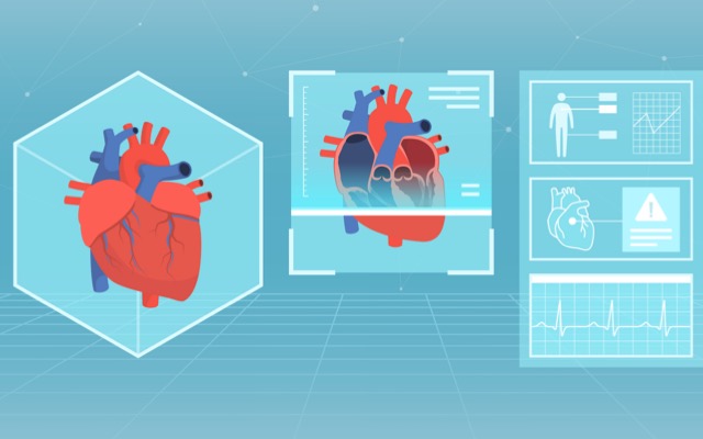 Echo IQ ASX EIQ AI artificial intelligence aortic stenosis heart cardiovascular HeartX