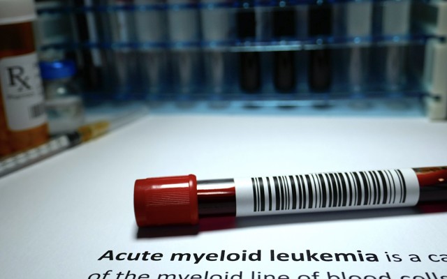 Race Oncology ASX RAC Acute Myeloid Leukaemia bisantrene Phase 2 clinical trial