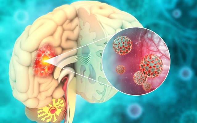 Radiopharm Theranostics ASX RAD FDA radiopharmaceuticals brain metastases cancer treatment